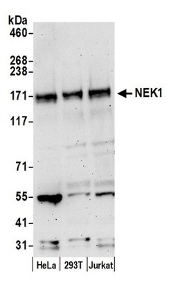 NEK1 Rabbit anti-Human, Polyclonal, Bethyl Laboratories 100 &mu;l; Unlabeled:Antibodies,