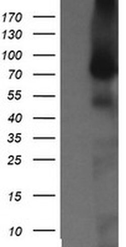 NEK11 Monoclonal Antibody (OTI5D9), TrueMAB , OriGene 30 &mu;L; Unconjugated:Antibodies,