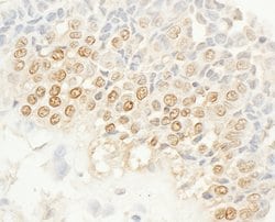 NEK4 Rabbit anti-Human, Polyclonal, Bethyl Laboratories 100 &mu;L; Unconjugated:Antibodies,