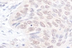 NEK7 Rabbit anti-Human, Polyclonal, Bethyl Laboratories 100 &mu;L; Unconjugated:Antibodies,