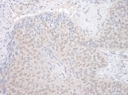 NEK7 Polyclonal Antibody, Bethyl Laboratories 10 &mu;l; Unlabeled:Antibodies,