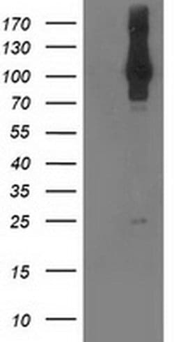 NEK9 Monoclonal Antibody (OTI7G7), TrueMAB , OriGene:Antibodies:Primary