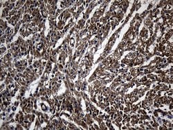 NES Monoclonal Antibody (OTI3B12), TrueMAB , OriGene 100 &mu;L; Unconjugated:Antibodies,