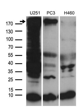 NES Monoclonal Antibody (OTI3B12), TrueMAB , OriGene 100 &mu;L; Unconjugated:Antibodies,