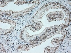 NEUROG1 Mouse anti-Human, Clone: OTI3F9, lyophilized, TrueMAB 100 &mu;g;