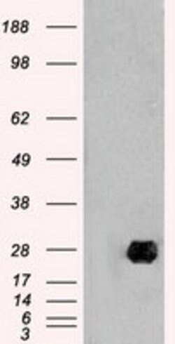 NEUROG1 Mouse anti-Human, Clone: OTI3F9, lyophilized, TrueMAB 100 &mu;g;