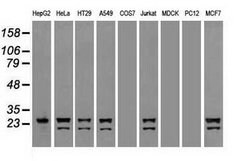 NEUROG1 Mouse anti-Human, Clone: OTI3F9, lyophilized, TrueMAB 100 &mu;g;