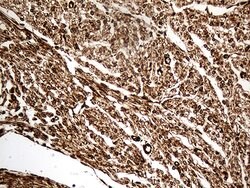 NF Mouse anti-Human, Clone: OTI3F7, lyophilized, TrueMAB 100 &mu;g; Unconjugated:Antibodies,