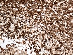 NF Mouse anti-Human, Clone: OTI3F7, lyophilized, TrueMAB 100 &mu;g; Unconjugated:Antibodies,
