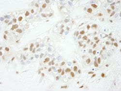 NF-YC Polyclonal Antibody, Bethyl Laboratories 100 &mu;L; Unconjugated:Antibodies,