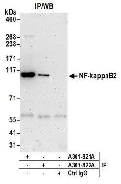 NF-kappaB2 Rabbit anti-Human, Mouse, Polyclonal, Bethyl Laboratories 100
