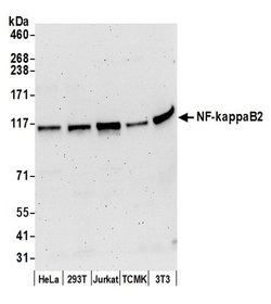 NF-kappaB2 Rabbit anti-Human, Mouse, Polyclonal, Bethyl Laboratories 100