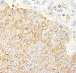 NF2 Rabbit anti-Human, Polyclonal, Bethyl Laboratories 100 &mu;L; Unconjugated:Antibodies,
