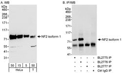 NF2 Rabbit anti-Human, Polyclonal, Bethyl Laboratories 100 &mu;L; Unconjugated:Antibodies,