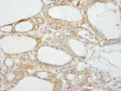 NF2 Polyclonal Antibody, Bethyl Laboratories 10 &mu;L; Unconjugated:Antibodies,