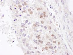 NF90/NF110 Rabbit anti-Human, Mouse, Polyclonal, Bethyl Laboratories 100
