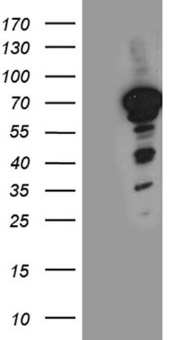 NFIA Monoclonal Antibody (OTI6F1), TrueMAB , OriGene 100 &mu;L; Unconjugated:Antibodies,