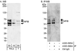 NFIB Rabbit anti-Human, Polyclonal, Bethyl Laboratories 100 &mu;L; Unconjugated:Antibodies,