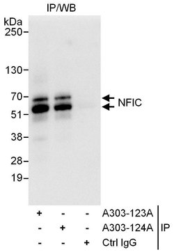 NFIC Rabbit anti-Human, Polyclonal, Bethyl Laboratories 100 &mu;L; Unconjugated:Antibodies,