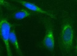 NFKBIA Monoclonal Antibody (OTI2F5), TrueMAB , OriGene 100 &mu;L; Unconjugated:Antibodies,