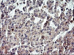 NFKBIA Monoclonal Antibody (OTI2F5), TrueMAB , OriGene 100 &mu;L; Unconjugated:Antibodies,