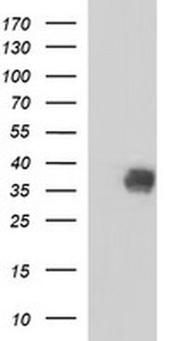 NFKBIA Monoclonal Antibody (OTI2F5), TrueMAB , OriGene 100 &mu;L; Unconjugated:Antibodies,