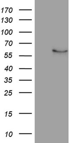 NFKBIE Monoclonal Antibody (OTI1E5), TrueMAB , OriGene 100 &mu;L; Unconjugated:Antibodies,