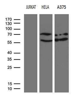 NFKBIE Monoclonal Antibody (OTI1E5), TrueMAB , OriGene 100 &mu;L; Unconjugated:Antibodies,