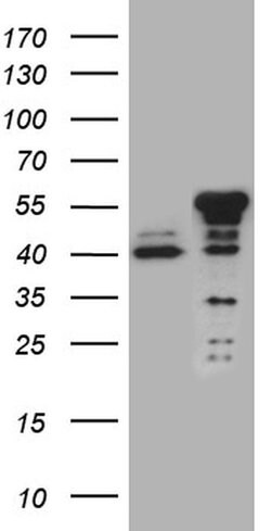 NFKBIE Monoclonal Antibody (OTI6G9), TrueMAB , OriGene 30 &mu;L; Unconjugated:Antibodies,