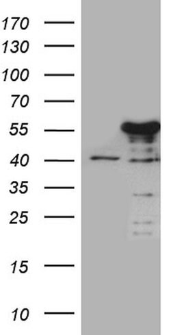 NFKBIE Mouse anti-Human, Clone: OTI5D11, lyophilized, TrueMAB 100 &mu;g;