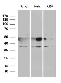 NFKBIE Mouse anti-Human, Clone: OTI5D11, lyophilized, TrueMAB 100 &mu;g;