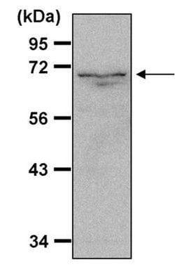 Invitrogen NFkB p65 Polyclonal Antibody 1 mL; Unconjugated:Anticuerpos