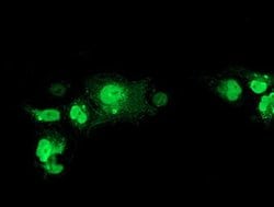 NHEJ1 Mouse anti-Human, Clone: OTI3B5, lyophilized, TrueMAB 100 &mu;g;