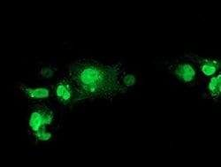 NHEJ1 Monoclonal Antibody (OTI3B5), TrueMAB , OriGene:Antibodies:Primary