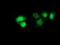 NHEJ1 Mouse anti-Human, Clone: OTI3E6, lyophilized, TrueMAB 100 &mu;g;