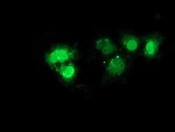 NHEJ1 Monoclonal Antibody (OTI3E6), TrueMAB , OriGene 30 &mu;L; Unconjugated:Antibodies,