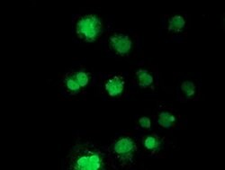 NHEJ1 Monoclonal Antibody (OTI2C8), TrueMAB , OriGene 100 &mu;L; Unconjugated:Antibodies,