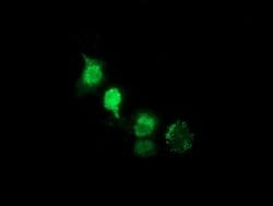 NHEJ1 Monoclonal Antibody (OTI1G7), TrueMAB , OriGene 100 &mu;L; Unconjugated:Antibodies,