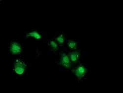 NHEJ1 Monoclonal Antibody (OTI1E2), TrueMAB , OriGene:Antibodies:Primary
