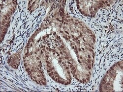 NHEJ1 Monoclonal Antibody (OTI1F3), TrueMAB , OriGene 100 &mu;L | Buy Online | Origene Technologies | Fisher Scientific