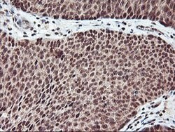 NHEJ1 Monoclonal Antibody (OTI1F3), TrueMAB , OriGene 100 &mu;L | Buy Online | Origene Technologies | Fisher Scientific