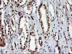 NHEJ1 Monoclonal Antibody (OTI1F3), TrueMAB , OriGene 100 &mu;L | Buy Online | Origene Technologies | Fisher Scientific
