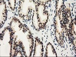 NHEJ1 Monoclonal Antibody (OTI3E6), TrueMAB , OriGene 30 &mu;L; Unconjugated:Antibodies,