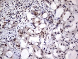 NHEJ1 Monoclonal Antibody (OTI1B5), TrueMAB , OriGene 30 &mu;L | Buy Online | Origene Technologies | Fisher Scientific