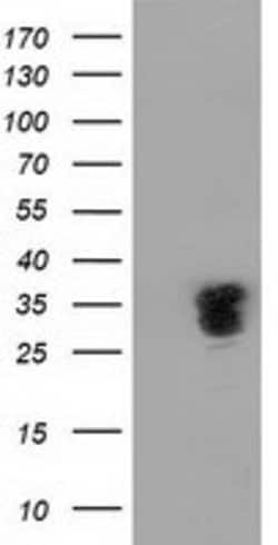 NHEJ1 Mouse anti-Human, Clone: OTI3B5, lyophilized, TrueMAB 100 &mu;g;