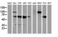 NHEJ1 Monoclonal Antibody (OTI3B5), TrueMAB , OriGene 100 &mu;L; Unconjugated:Antibodies,