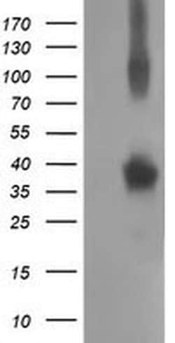 NHEJ1 Monoclonal Antibody (OTI1F3), TrueMAB , OriGene 100 &mu;L | Buy Online | Origene Technologies | Fisher Scientific