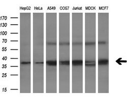 NHEJ1 Monoclonal Antibody (OTI1F3), TrueMAB , OriGene 100 &mu;L | Buy Online | Origene Technologies | Fisher Scientific