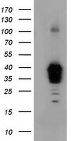NHEJ1 Monoclonal Antibody (OTI3E6), TrueMAB , OriGene 30 &mu;L; Unconjugated:Antibodies,