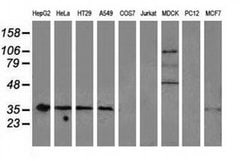 NHEJ1 Monoclonal Antibody (OTI3E6), TrueMAB , OriGene 30 &mu;L; Unconjugated:Antibodies,
